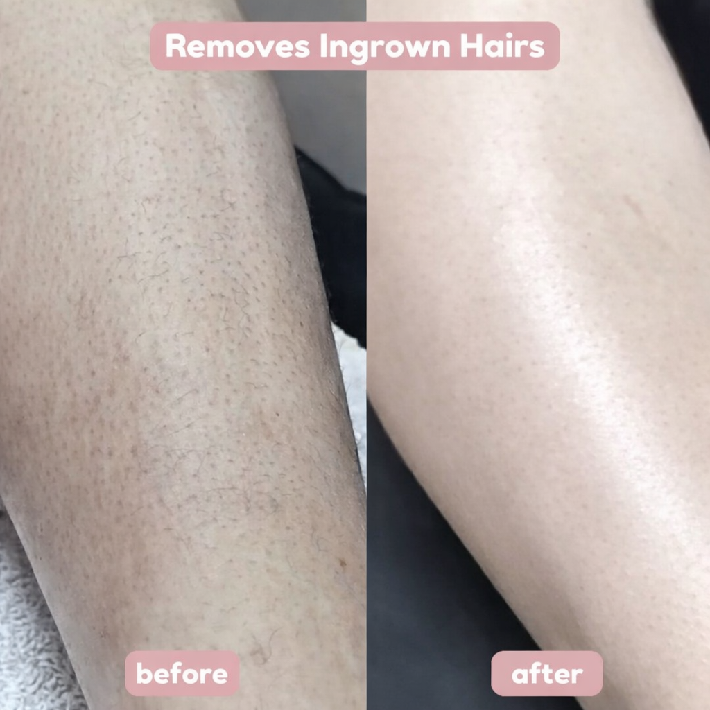 Alcuras™ 2-in-1 women's razor for smooth and well-groomed skin